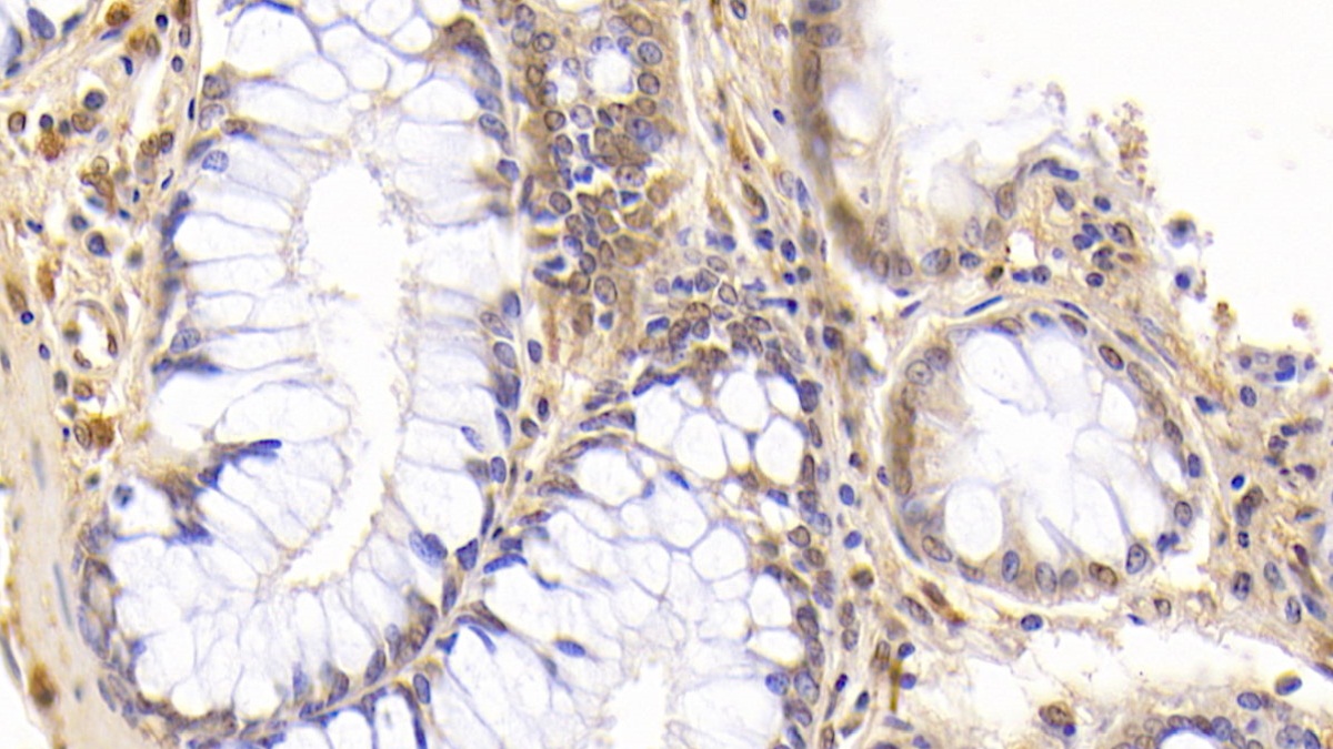 Monoclonal Antibody to Interferon Beta (IFNb)