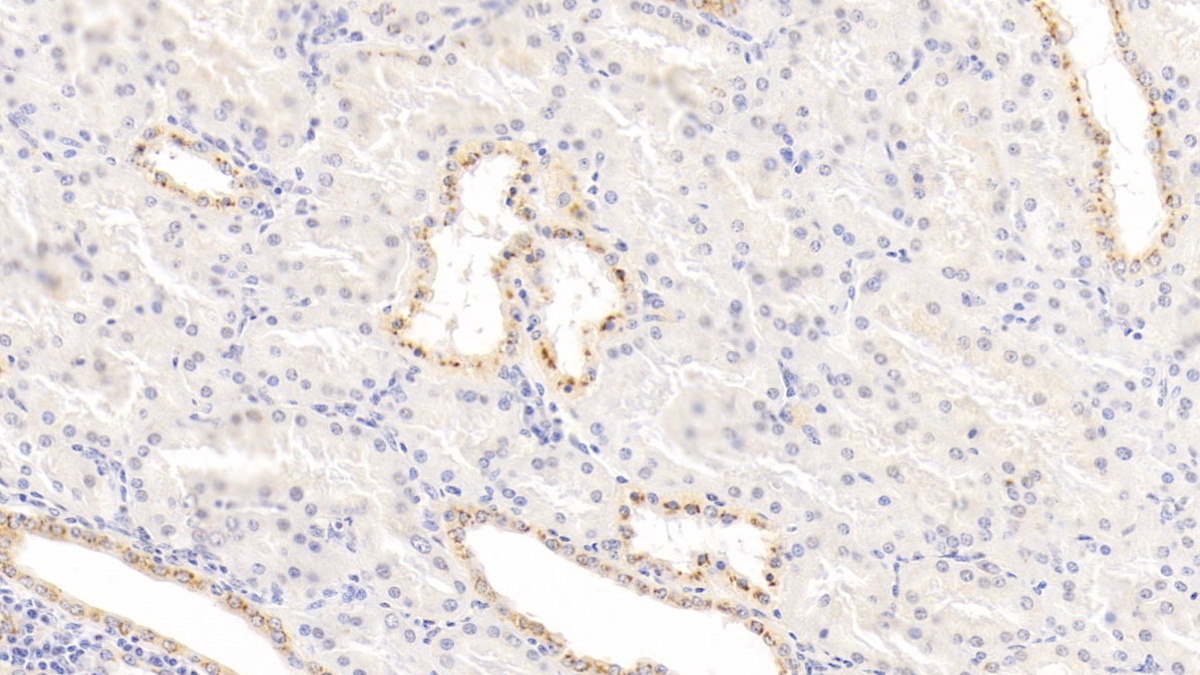 Monoclonal Antibody to Interleukin 1 Receptor Antagonist (IL1RA)