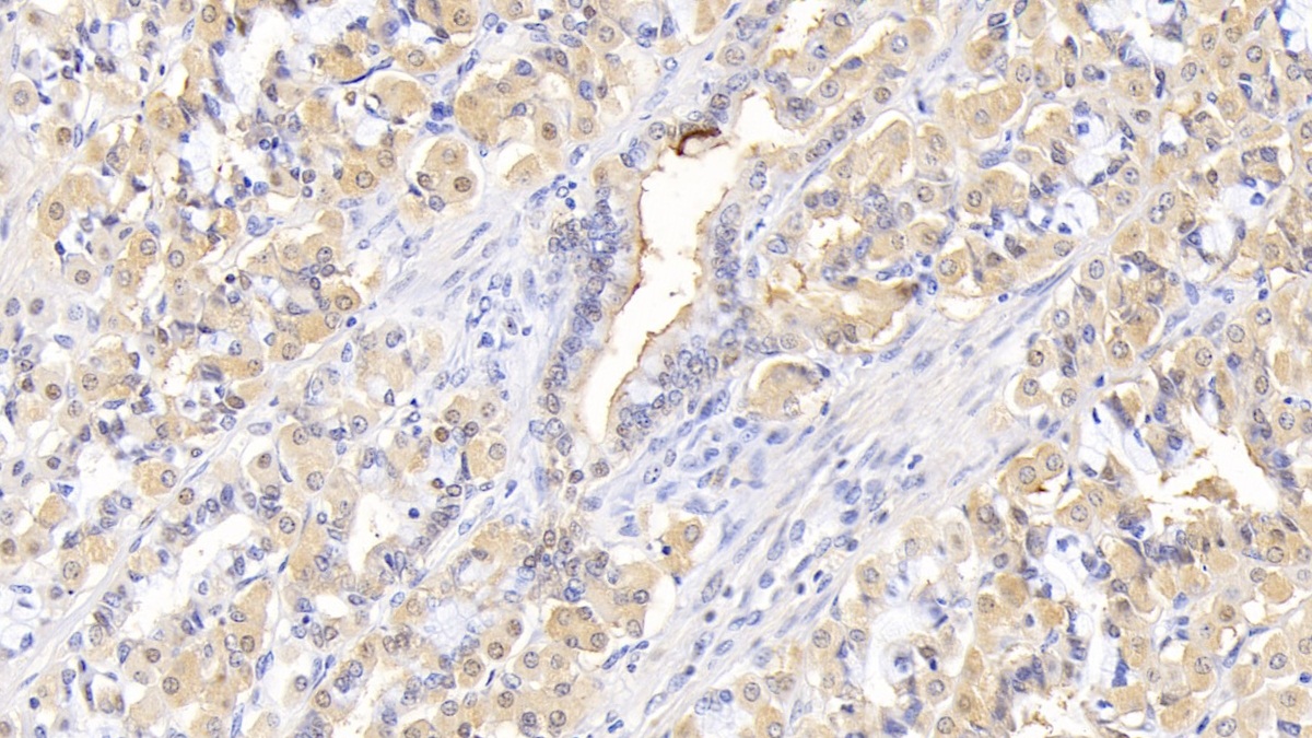 Monoclonal Antibody to Interleukin 1 Receptor Antagonist (IL1RA)