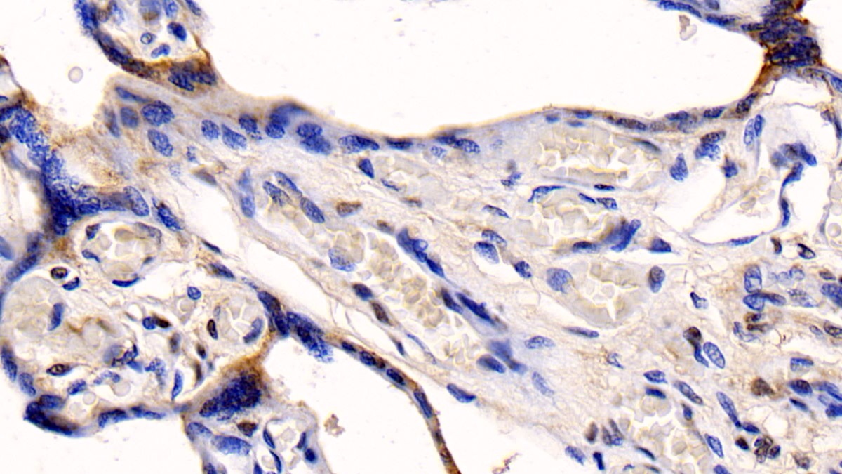 Monoclonal Antibody to Cyclophilin B (CYPB)