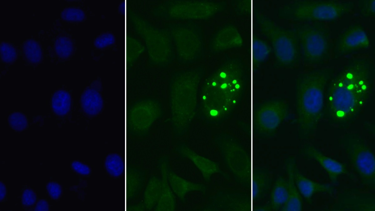 Monoclonal Antibody to Anti-Mullerian Hormone (AMH)