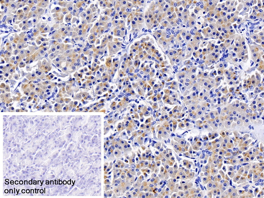 Monoclonal Antibody to Trypsin (TRY)