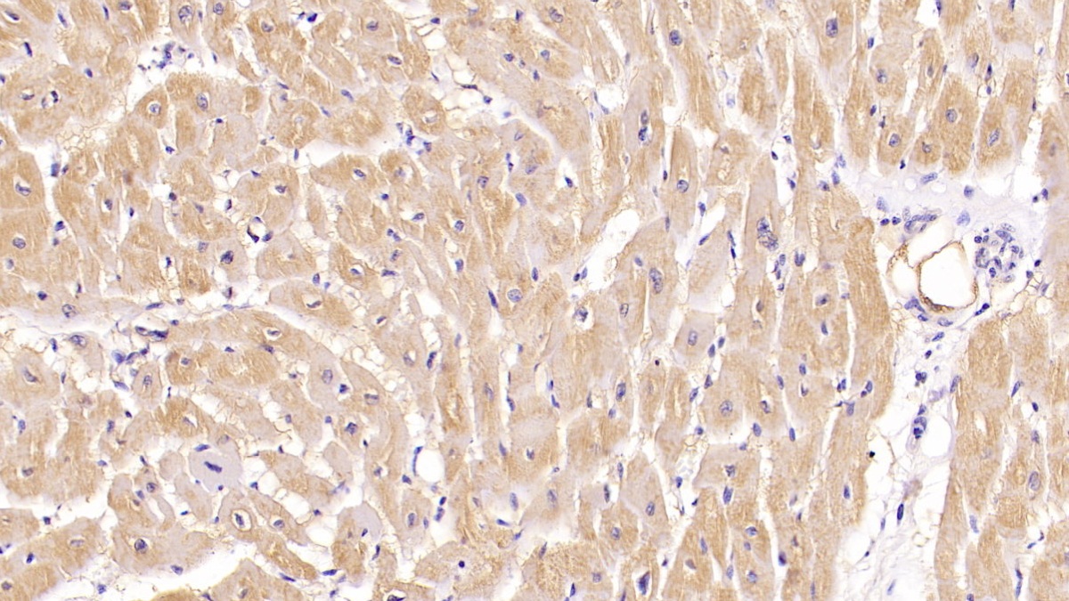 Monoclonal Antibody to Beta-2-Microglobulin (b2M)