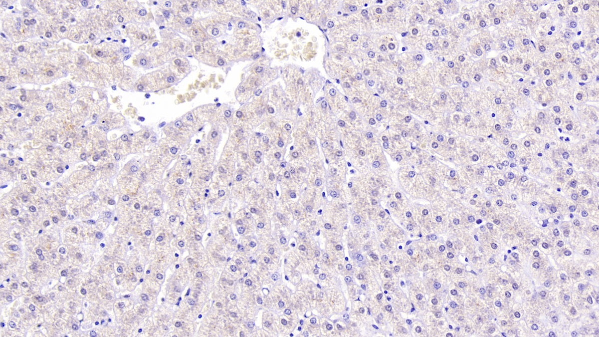 Monoclonal Antibody to Beta-2-Microglobulin (b2M)