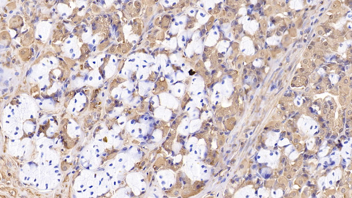 Monoclonal Antibody to Beta-2-Microglobulin (b2M)