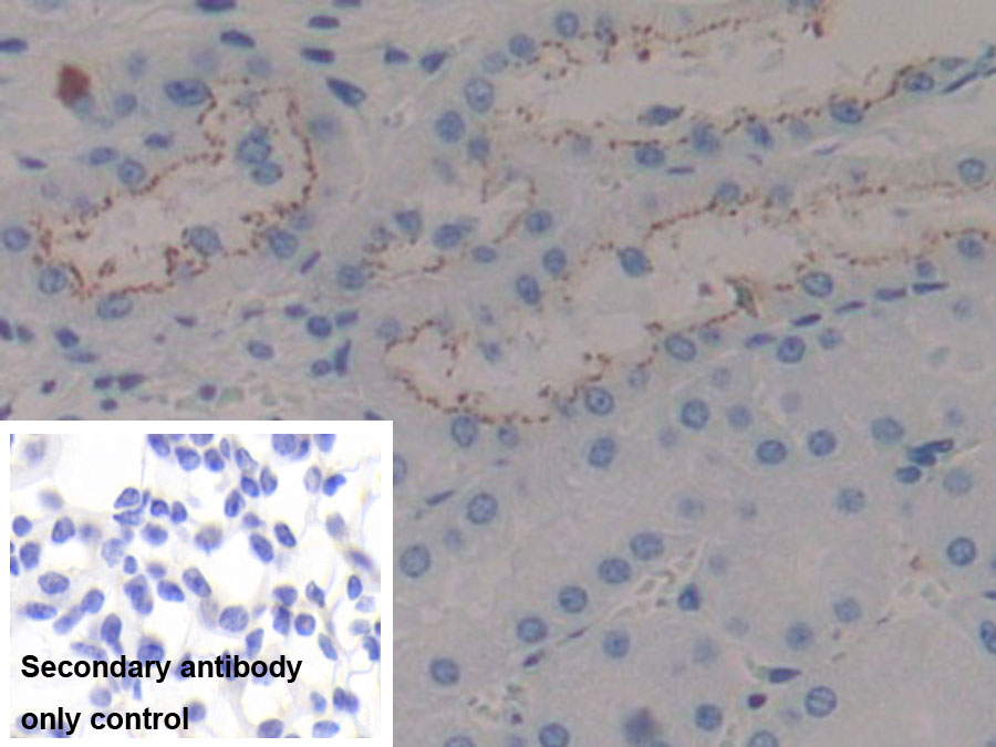 Monoclonal Antibody to Beta-2-Microglobulin (b2M)