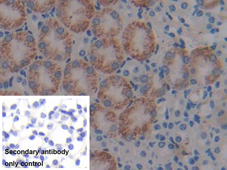 Monoclonal Antibody to Beta-2-Microglobulin (b2M)