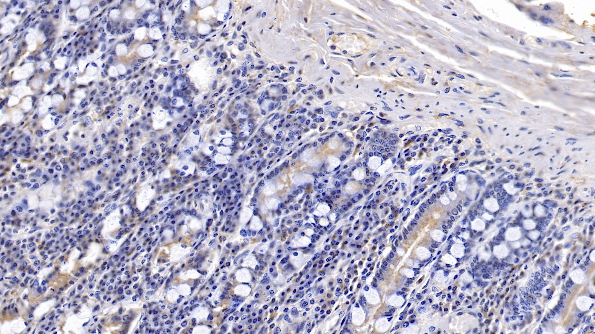 Monoclonal Antibody to Calnexin (CNX)