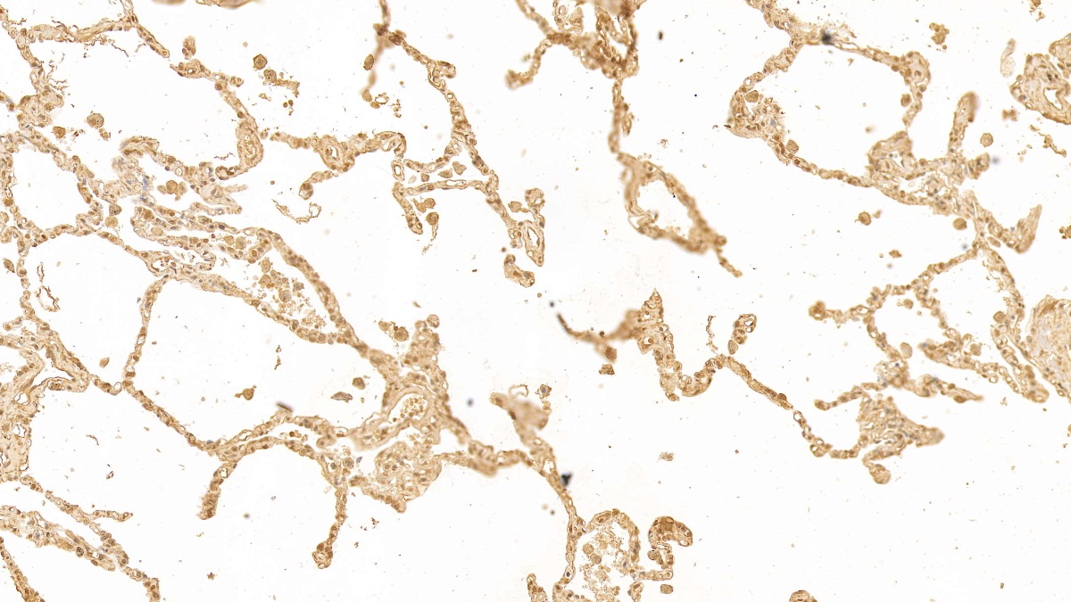 Monoclonal Antibody to Galectin 3 (GAL3)