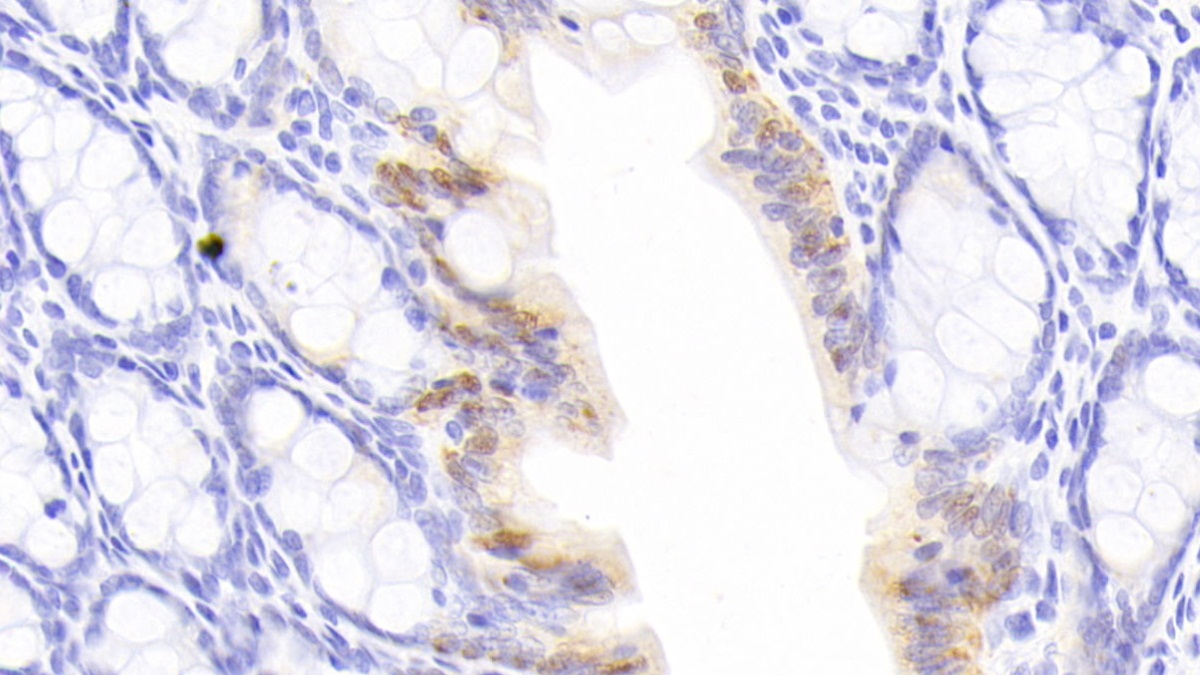 Monoclonal Antibody to Galectin 3 (GAL3)