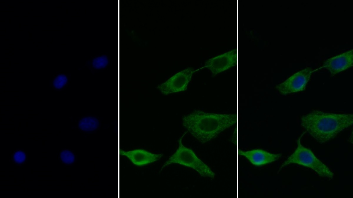 Monoclonal Antibody to Galectin 8 (GAL8)