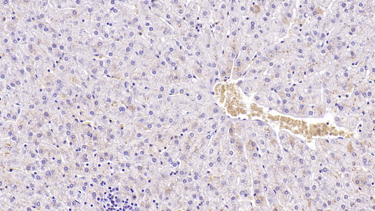 Monoclonal Antibody to Apolipoprotein H (APOH)