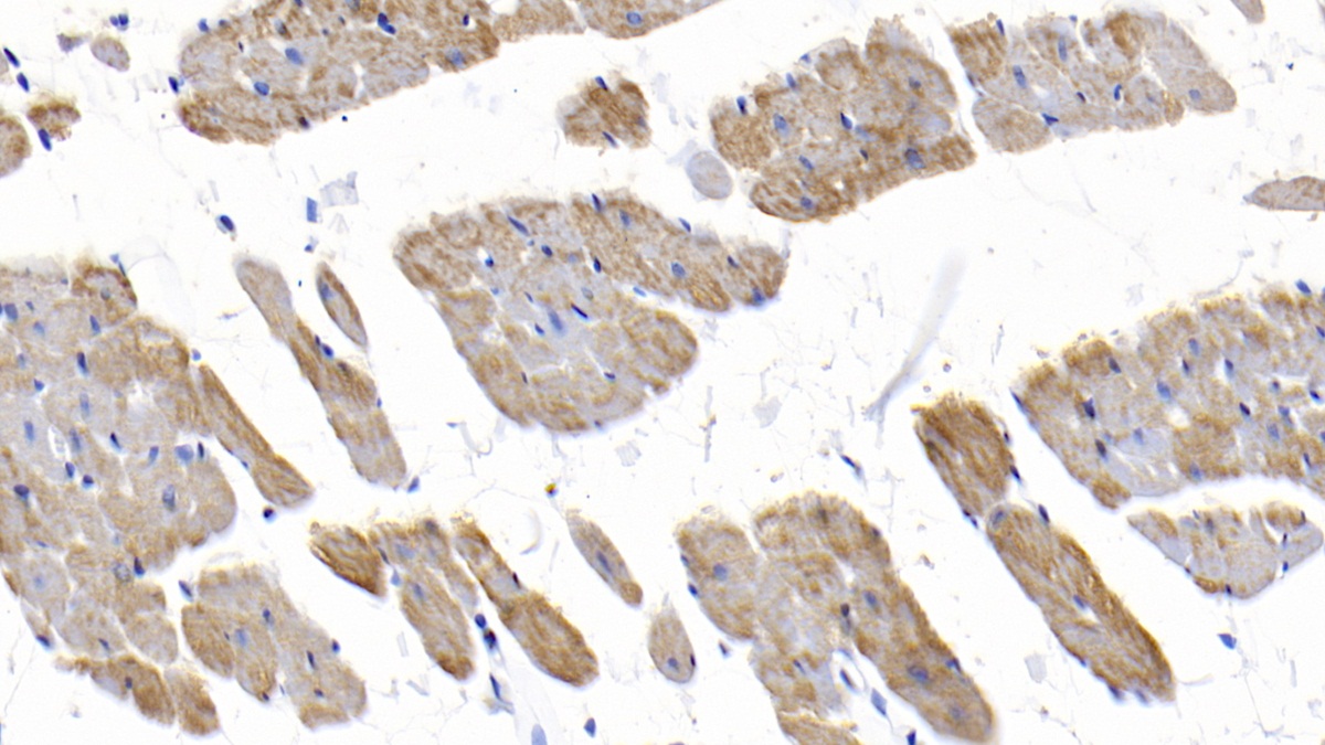 Monoclonal Antibody to Galectin 1 (GAL1)