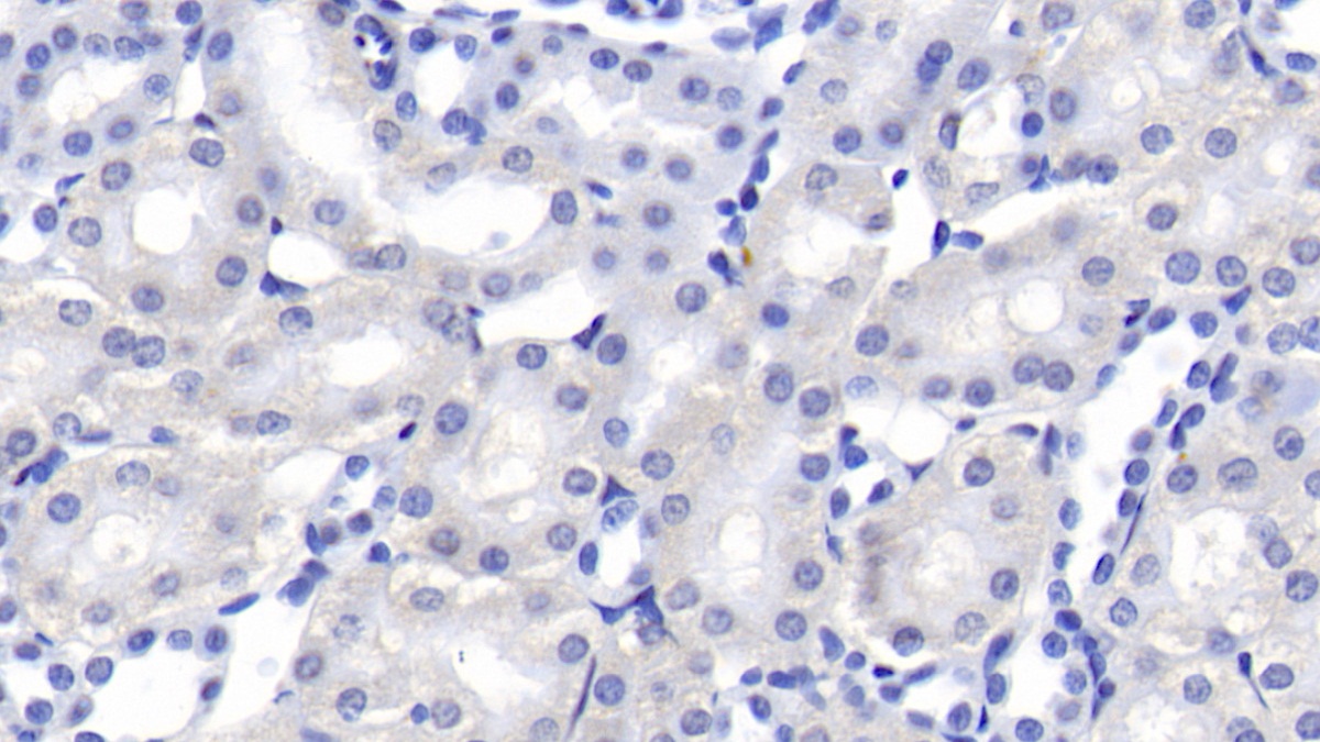 Monoclonal Antibody to Galectin 1 (GAL1)