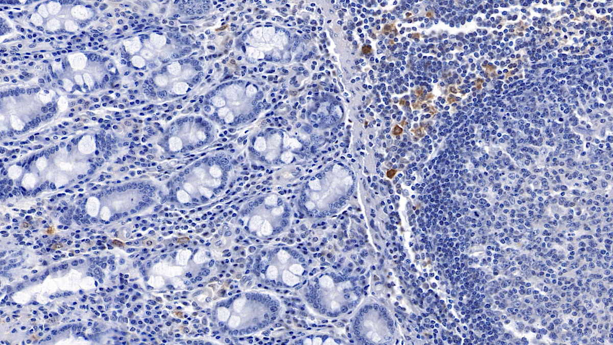 Monoclonal Antibody to Gelsolin (GSN)