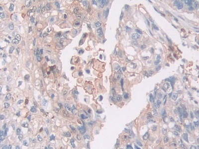 Monoclonal Antibody to Gelsolin (GSN)