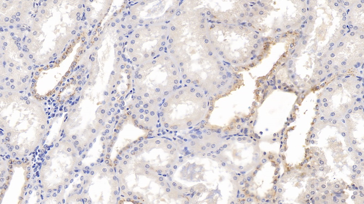 Monoclonal Antibody to Gelsolin (GSN)