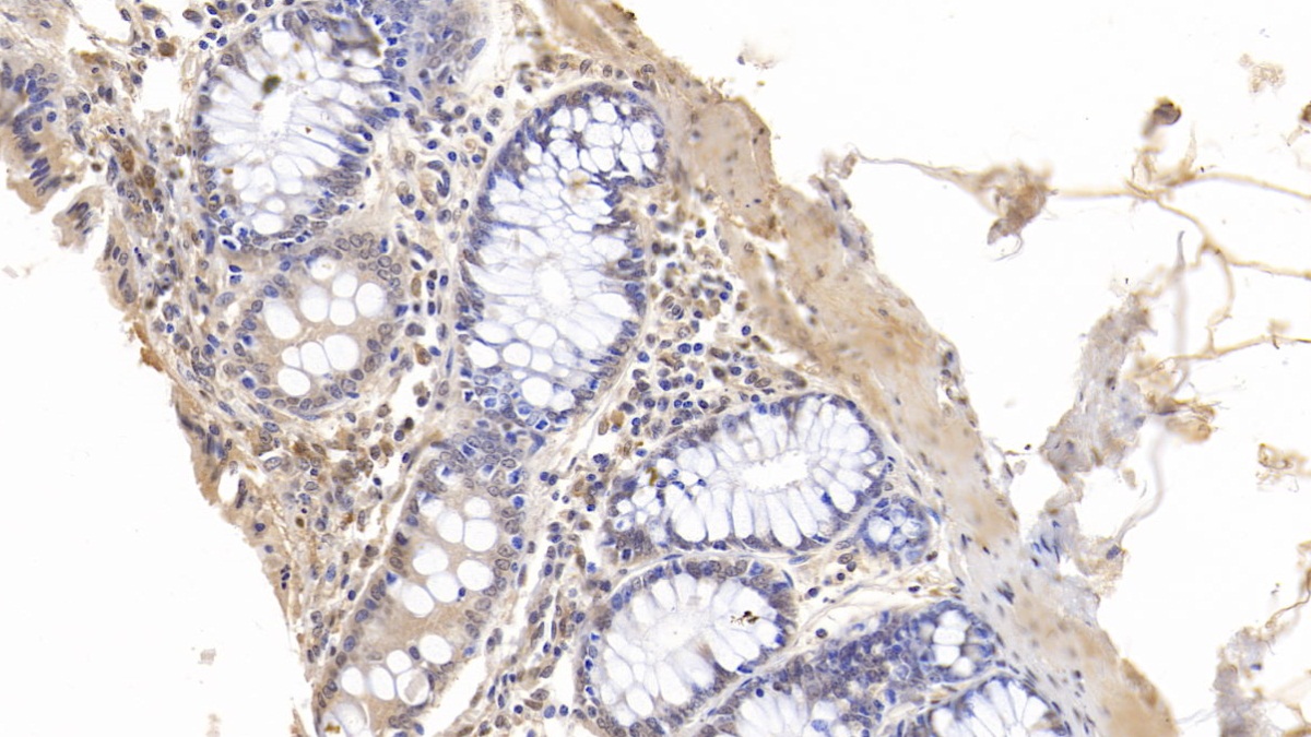 Monoclonal Antibody to Gelsolin (GSN)