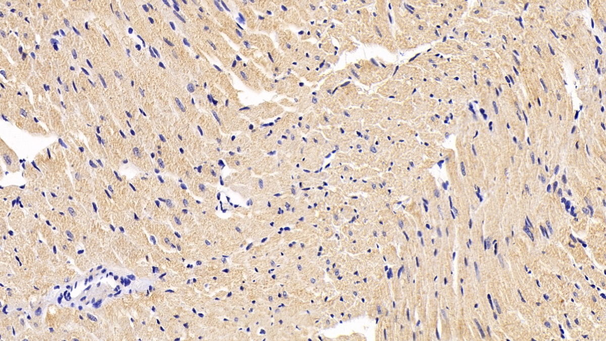 Monoclonal Antibody to Desmin (Des)