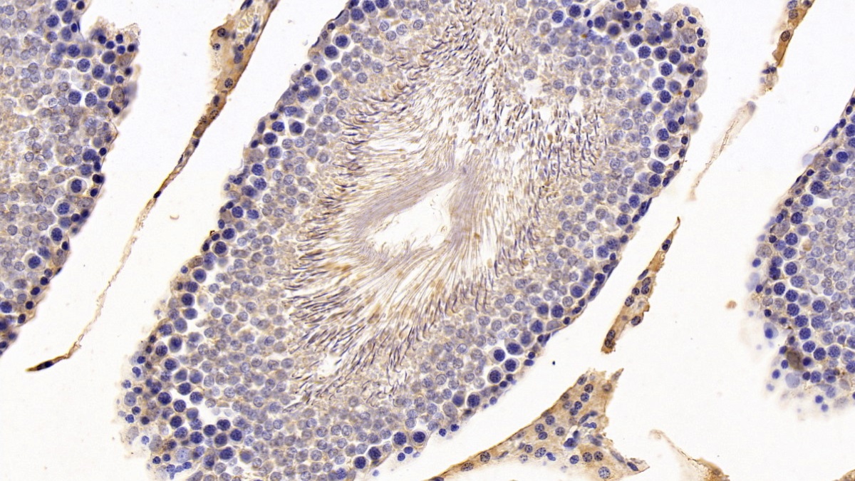 Monoclonal Antibody to Complement Component 3a (C3a)