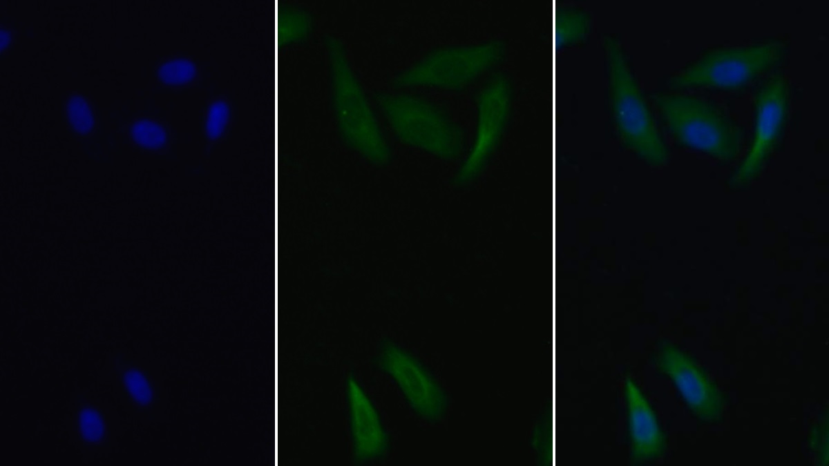 Monoclonal Antibody to Tissue Factor Pathway Inhibitor (TFPI)