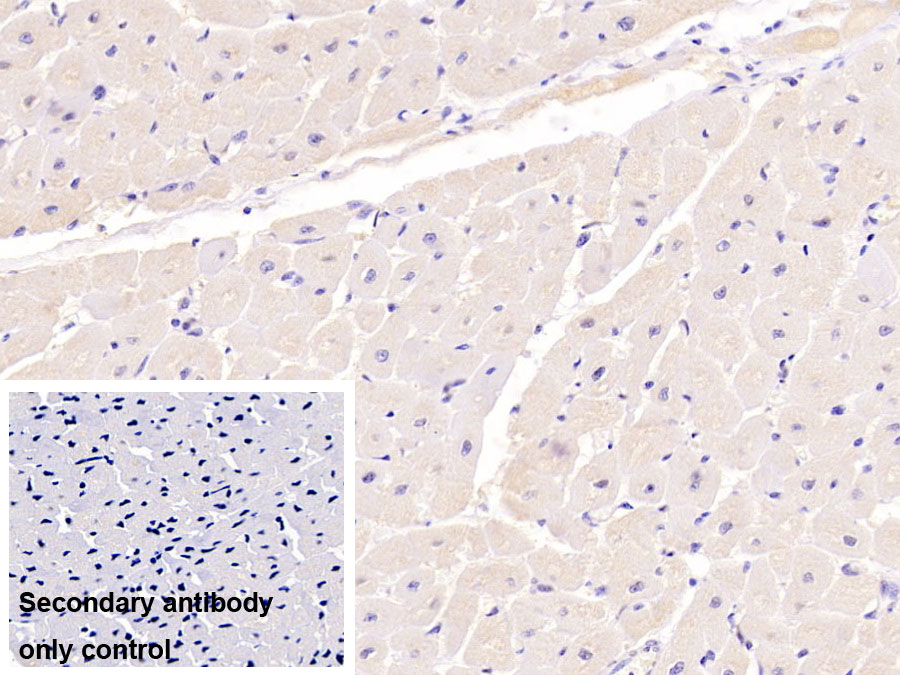 Monoclonal Antibody to Sex Hormone Binding Globulin (SHBG)