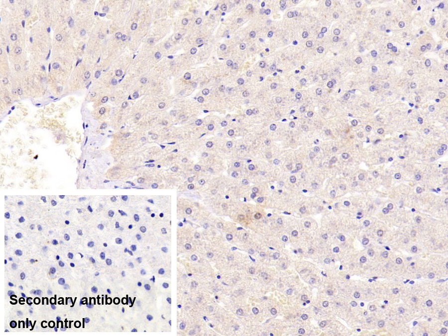 Monoclonal Antibody to Sex Hormone Binding Globulin (SHBG)