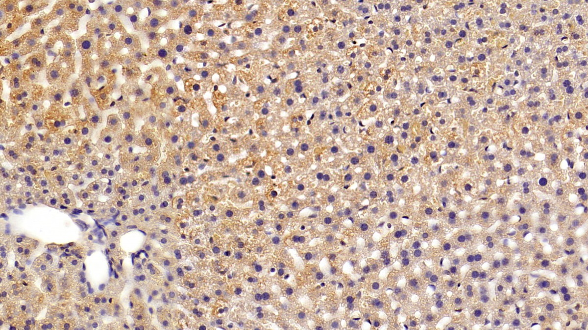 Monoclonal Antibody to Sex Hormone Binding Globulin (SHBG)