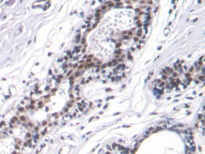 Monoclonal Antibody to High Mobility Group Protein 1 (HMGB1)