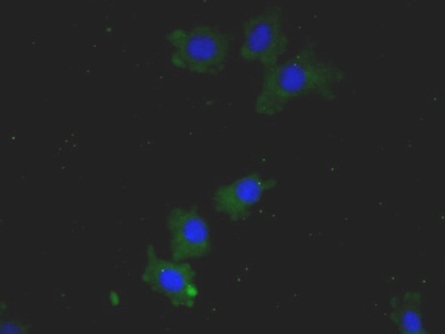 Monoclonal Antibody to High Mobility Group Protein 1 (HMGB1)