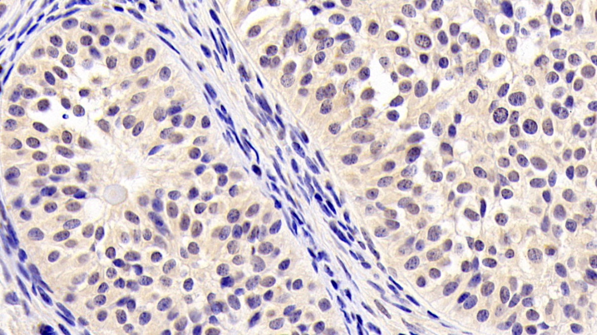 Monoclonal Antibody to Neurogranin (NRGN)