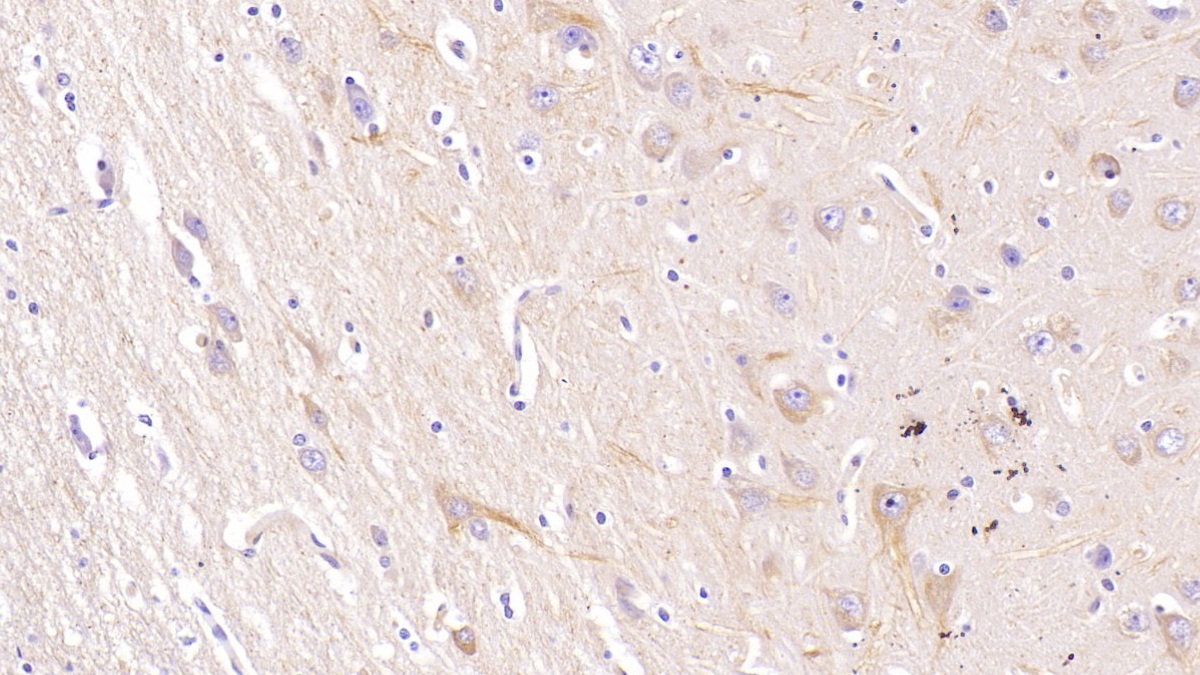 Monoclonal Antibody to Neurogranin (NRGN)