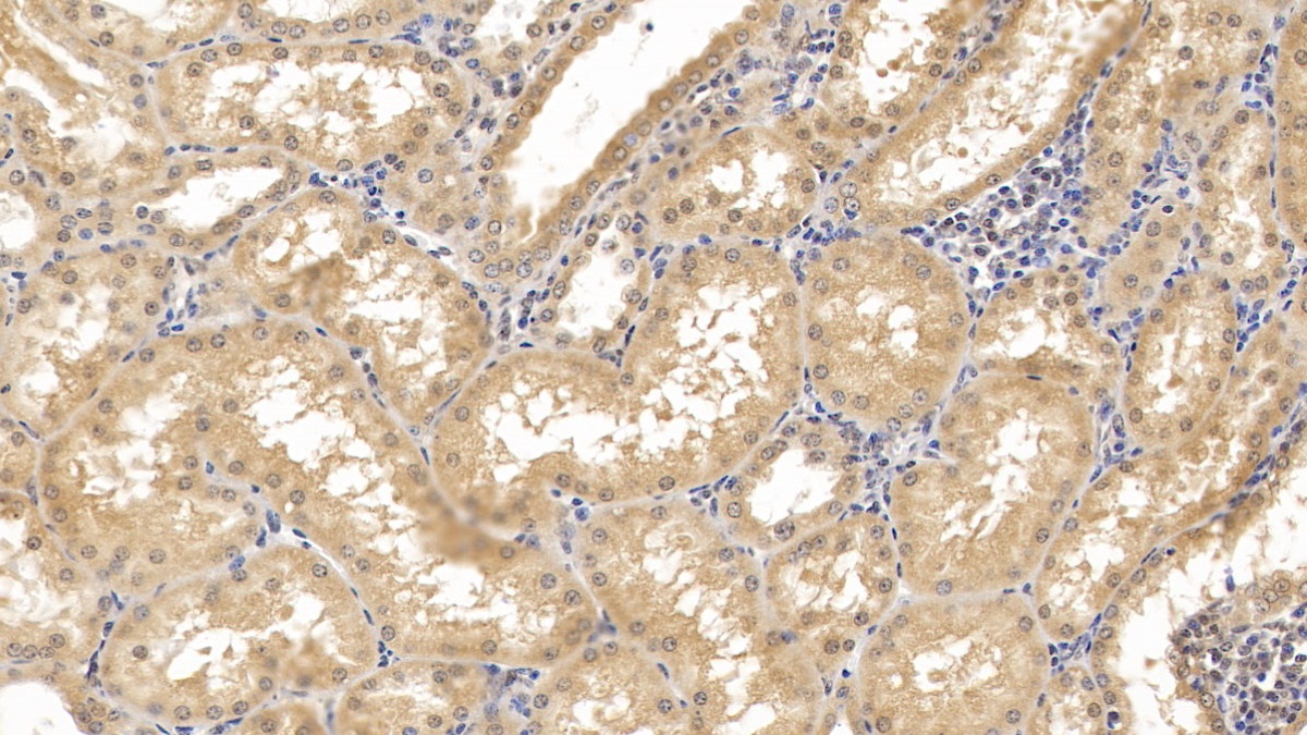 Monoclonal Antibody to GATA Binding Protein 3 (GATA3)