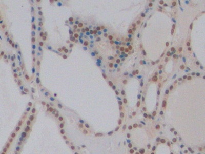 Monoclonal Antibody to GATA Binding Protein 3 (GATA3)