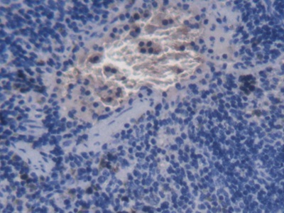 Monoclonal Antibody to Alpha-Hemoglobin Stabilizing Protein (aHSP)