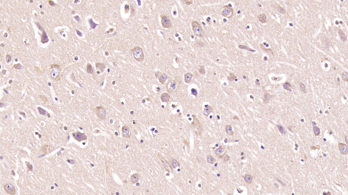 Monoclonal Antibody to Myelin Oligodendrocyte Glycoprotein (MOG)