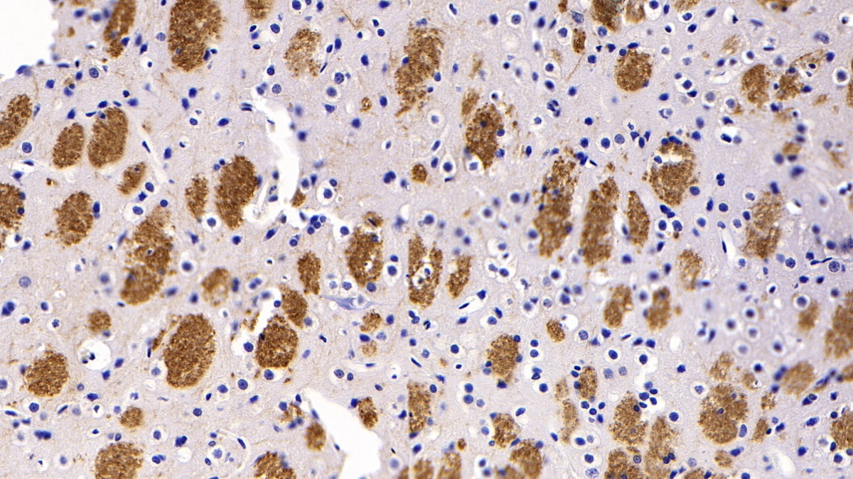 Monoclonal Antibody to Synaptophysin (SYP)