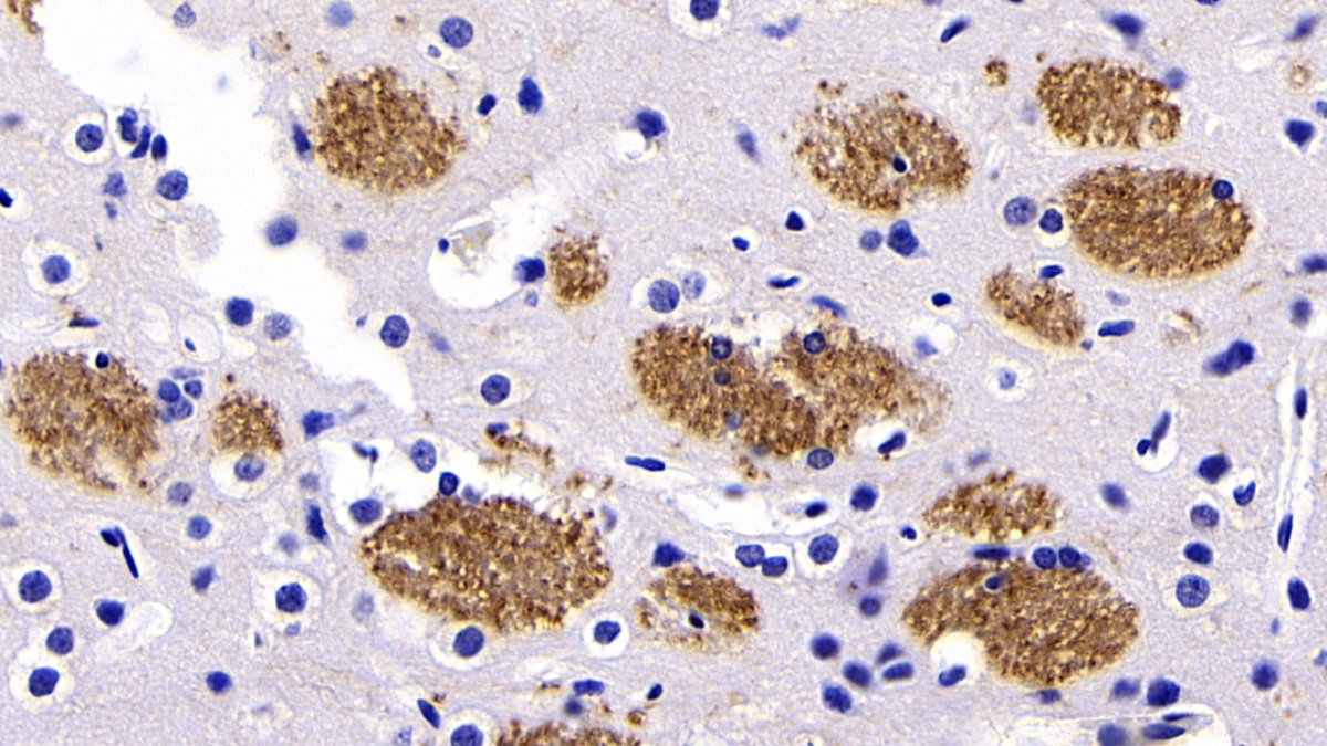 Monoclonal Antibody to Synaptophysin (SYP)