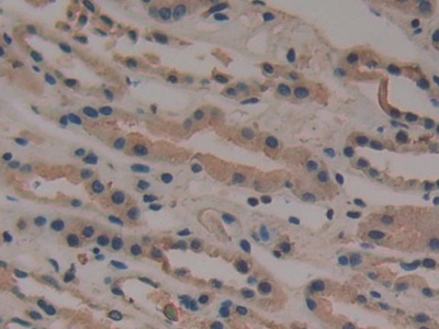 Monoclonal Antibody to Neurokinin A (NKA)