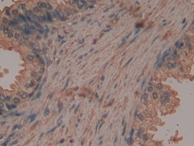 Monoclonal Antibody to Neurokinin A (NKA)