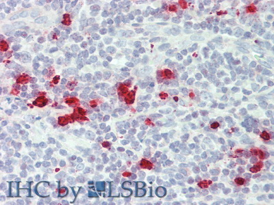 Monoclonal Antibody to Granzyme M (GZMM)