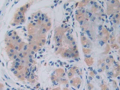 Monoclonal Antibody to Growth Hormone Releasing Hormone (GHRH)