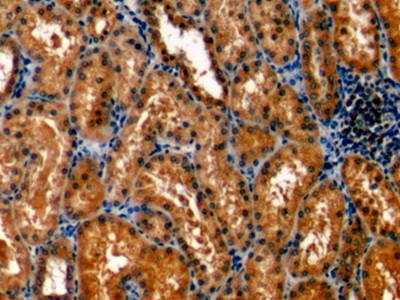 Monoclonal Antibody to Protein Kinase C Epsilon (PKCe)