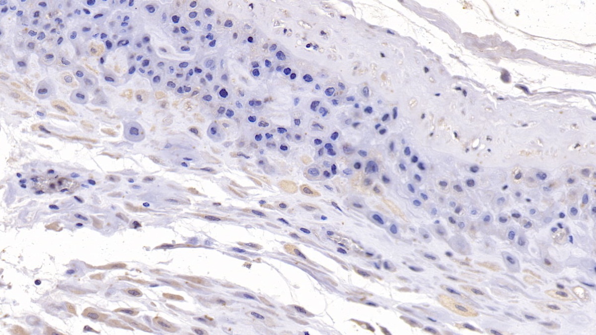 Monoclonal Antibody to Desmoglein 3 (DSG3)