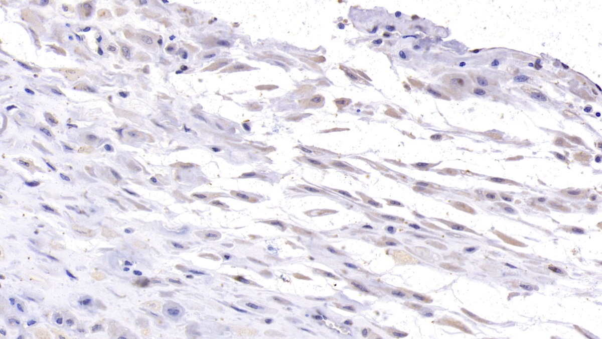 Monoclonal Antibody to Desmoglein 3 (DSG3)