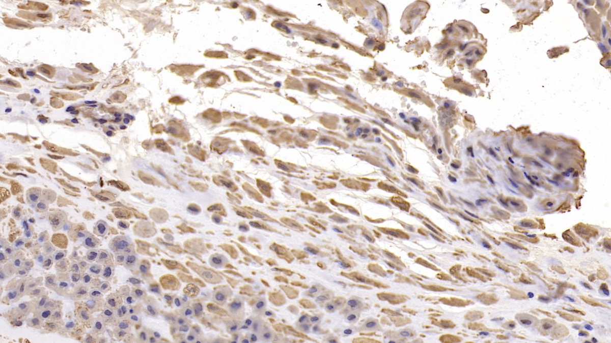 Monoclonal Antibody to Desmoglein 3 (DSG3)