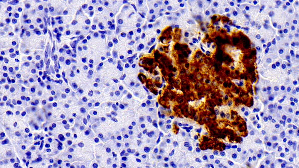 Monoclonal Antibody to Insulin (INS)