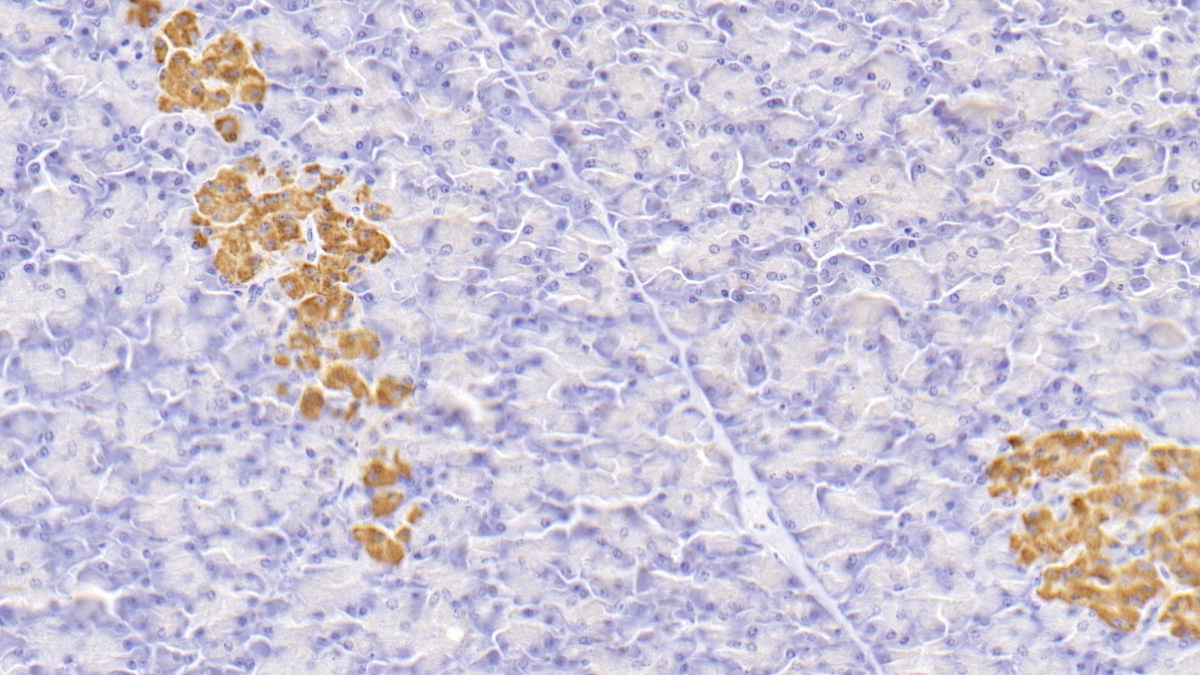 Monoclonal Antibody to Insulin (INS)