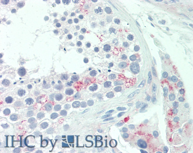 Monoclonal Antibody to Estradiol (E2)