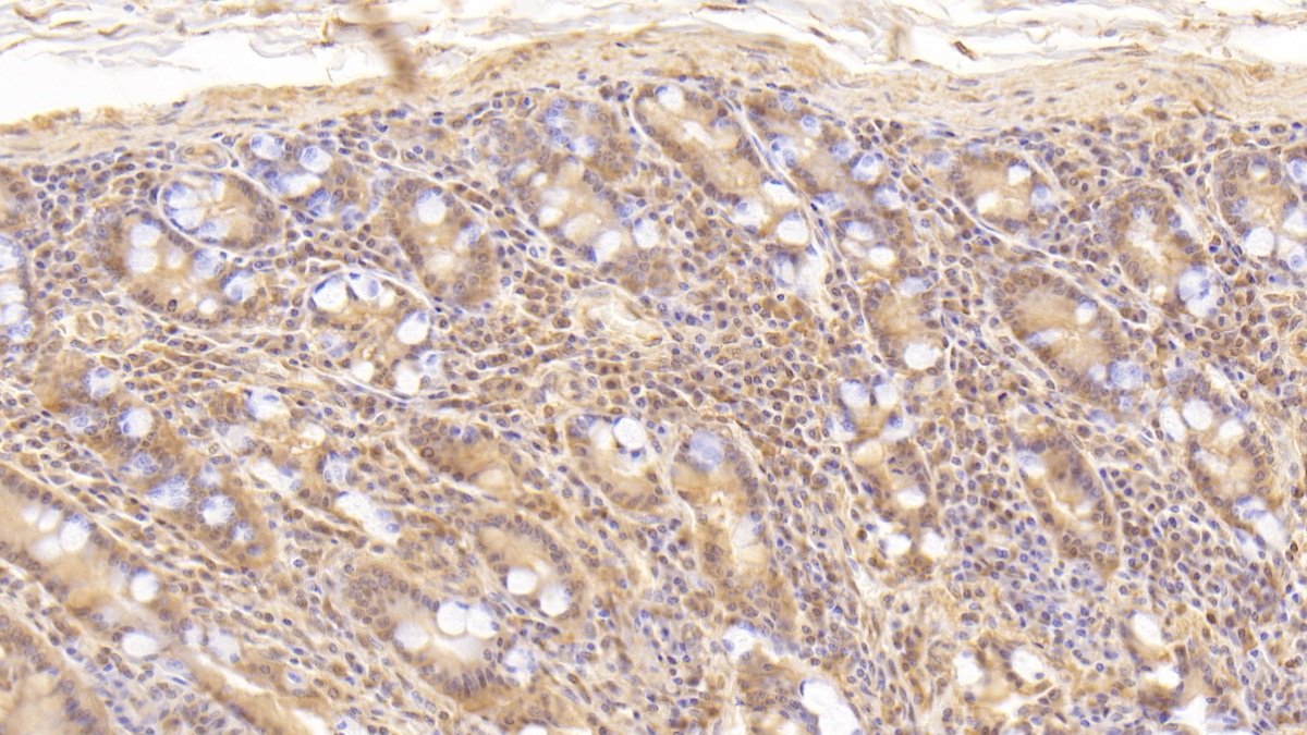 Monoclonal Antibody to Cluster Of Differentiation 55 (CD55)